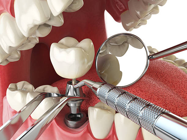 Best Urgent Dental Care for Toothache in Spearman, TX